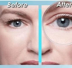 Easy Lift Butterfly Ooglitstickers Ooglidtape Ooglidstickers - Lift Je Oogleden Zonder Operatie - Tegen Hangende Ogen -Essie winkel 550x233 2