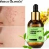 VIBRANT GLAMOUR Herbal Acne Serum - Acne - Puistjes - SerumAcne - Face Serum - Anti Acne Collageen - Gezichtsverzorging - Gezicht Serum -Essie winkel 550x503 3