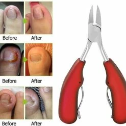 IGOODS Nagelriem Knipper - Professionele Teennagelknipper Cutter Tang - RVS - Zwart - Dikke Nagels Tool Gesneden Nagel - Teen Trimmer -Essie winkel 550x507 11