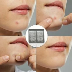 Mystige Pimple Patch 108 ST - Acne Patch - Puisten Verwijderaar - Pimple Patches - Acne Pleister - Puistjes Verwijderen -Essie winkel 550x550 192