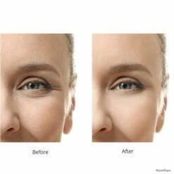 Marnifique Micro-Needle 0.5mm Derma Roller - Dermapen - Microneedling - Gezichtsroller - Face Roller - Gezichts- En Huidverzorging - Huidverjonging - Steriel Verpakt - Gezichtsserum - 24k Gold Serum - Sinterklaas Cadeau - Kerstcadeau -Essie winkel 550x550 291