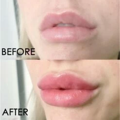 Karit? Organ Oil Lip Plumper - Extract & Vitamine E - Lipgloss - Instant Lip Maximizer -Essie winkel 550x550 340