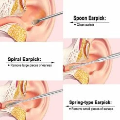 Merkloos 5 Delige RVS Oorsmeer Verwijderaar Oorreiniger. -Essie winkel 550x550 692