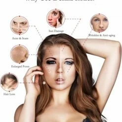 Kingsowned Dermaroller 1.5 Mm Met Cleaning Spray - 540 Naalden - Steriel Verpakt - Hoge Kwaliteit Chirurgisch Staal - Bewezen Effectief Tegen Rimpels, Acne Littekens, En Cellulitis & Stimulatie Van Haargroei Op De Hoofdhuid, Baardgroei -Essie winkel 550x593 2