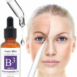 Niyelle Vitamine B3 Serum - Niacinamide - Gezichtsserum - Hyaluronzuur - Vitamine E - Collageen - Anti Aging - Acne - Tegen Mee-eters En Grove Pori N - Tegen Pigmentvlekken - Skin Care - Anti Rimpel - 100% Natuurlijk - 30ml -Essie winkel 550x617 6